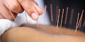 Solace Curatio Naturopathy and Yoga Clinic Dr Vanupriya(AYUSH) — Ayurveda in Manipur, Manipur clinic listing photo