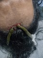 Dr. Chaitanya Gupta — Ayurveda in Indore, Madhya Pradesh clinic listing photo