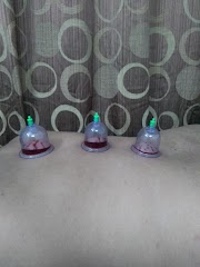Ayushyavedam Panchkarma & Ayurveda Clinic — Ayurveda in Indore, Madhya Pradesh clinic photo on OPDIO - Smart Clinic. Smarter Care.