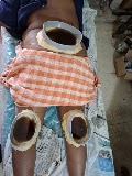 Ayurveda Panchakarma Yog Centre — Ayurveda in Patna, Bihar clinic listing photo