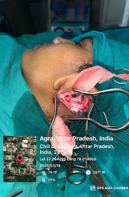 DR L K GUPTA — Doctors in Gandhi Nagar, Uttar Pradesh clinic photo on OPDIO - Smart Clinic. Smarter Care.