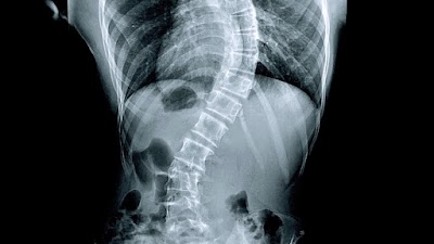 Dr Ranjith Unnikrishnan — Orthopedics in Thiruvananthapuram, Kerala clinic photo on OPDIO - Smart Clinic. Smarter Care.