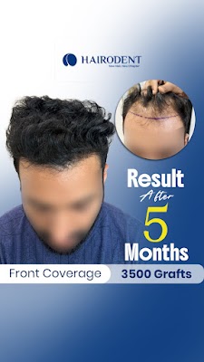 Hair O Dent - Hair Transplant Experts, Kochi — Dentistry in Gandhi Nagar, Kerala clinic photo on OPDIO - Smart Clinic. Smarter Care.