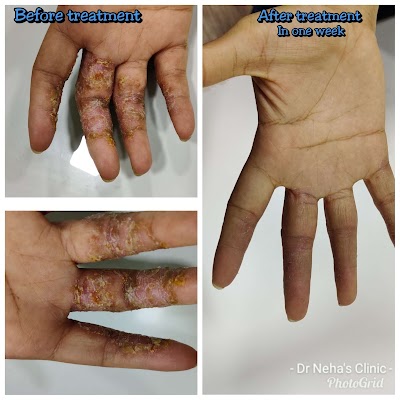 Dr. NEHA AGARWAL HOMOEOPATHY CLINIC — Homeopathy in Sowcarpet, Tamil Nadu clinic listing photo
