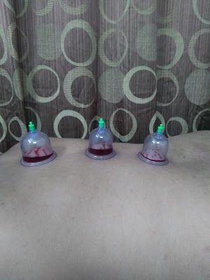 Ayushyavedam Panchkarma & Ayurveda Clinic — Ayurveda in Indore, Madhya Pradesh clinic photo on OPDIO - Smart Clinic. Smarter Care.