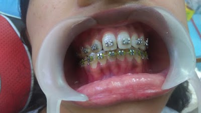 Dr Mukesh Gupta — Dentistry in Sindhi Colony, Rajasthan clinic listing photo