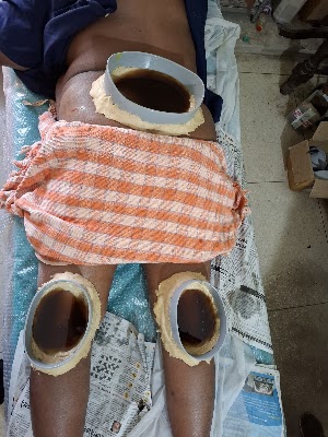 Ayurveda Panchakarma Yog Centre — Ayurveda in Patna, Bihar clinic listing photo