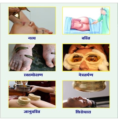 Shri Vishwasurya Ayurved Hospital and Panchakarma, Agnikarma, Viddhakarma centre — Ayurveda in Raipur, Chhattisgarh clinic photo on OPDIO - Smart Clinic. Smarter Care.